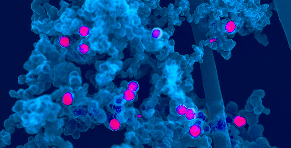 Palladium System Palladium | Johnson Matthey